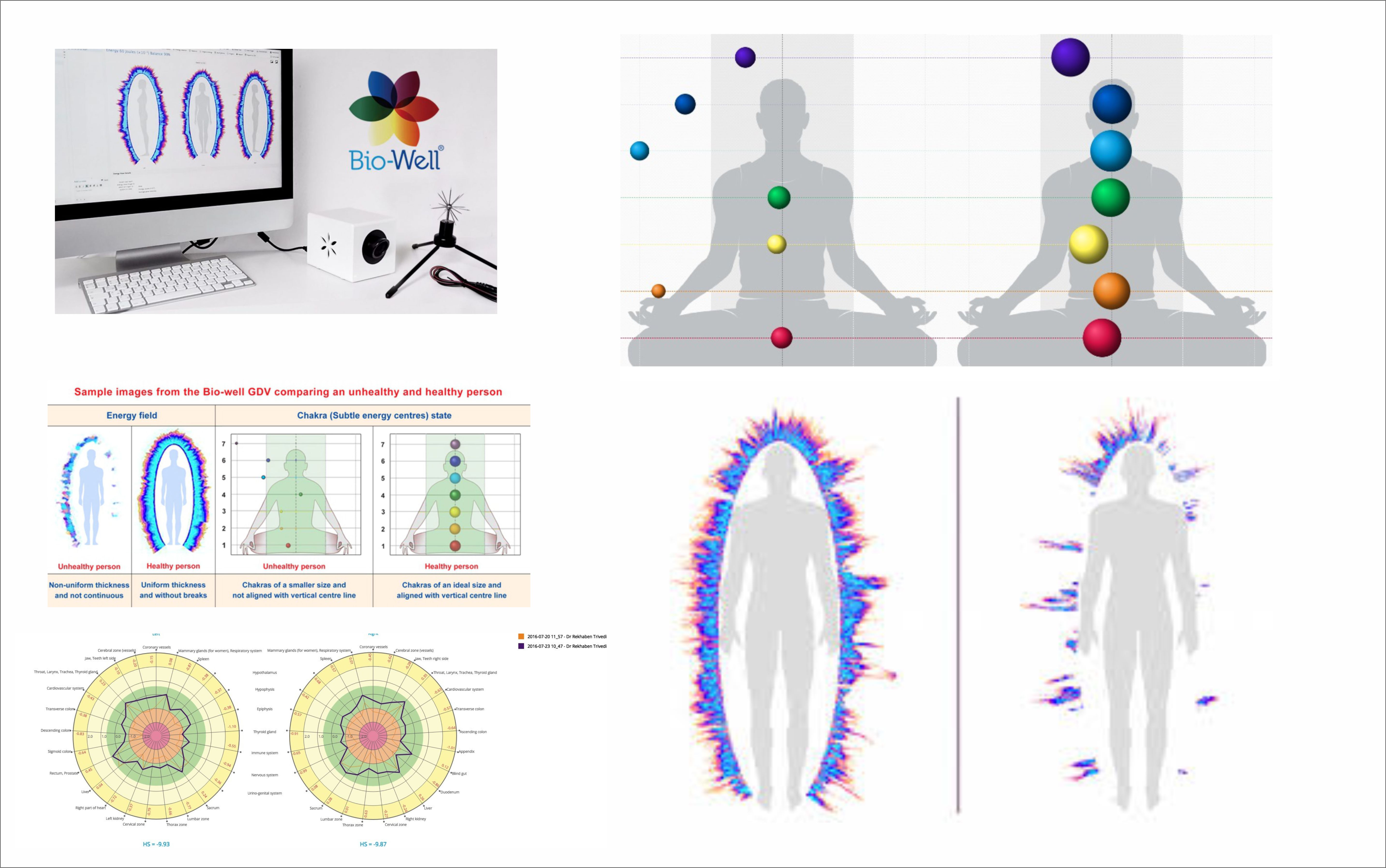 Why people choose GDV